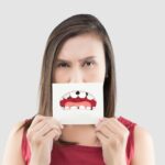 Caries dental, ¿qué es y cómo prevenirla?