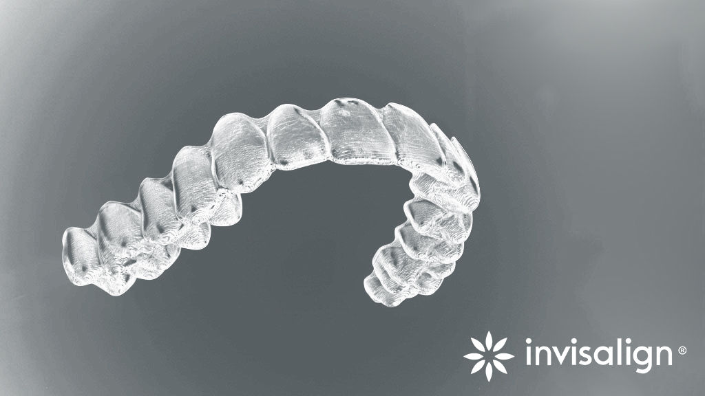 invisalign-ibiza-ortodoncia-invisible